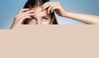 為什么額頭長痘 快來看看原因有哪些