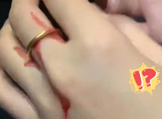 女子50元買倉鼠被咬花1000元 背后真相實在讓人驚愕