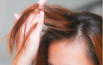 發質細軟怎么改善