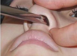 鼻毛變白是什么現象?