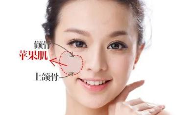 蘋果肌好看還是不好看？女生有蘋果肌好看嗎？