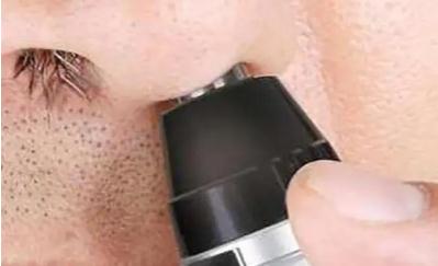 鼻毛變白什么征兆?鼻毛變白是什么征兆?