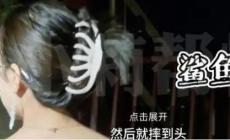 鯊魚夾是有危害的！女子頭戴鯊魚夾摔倒后成植物人